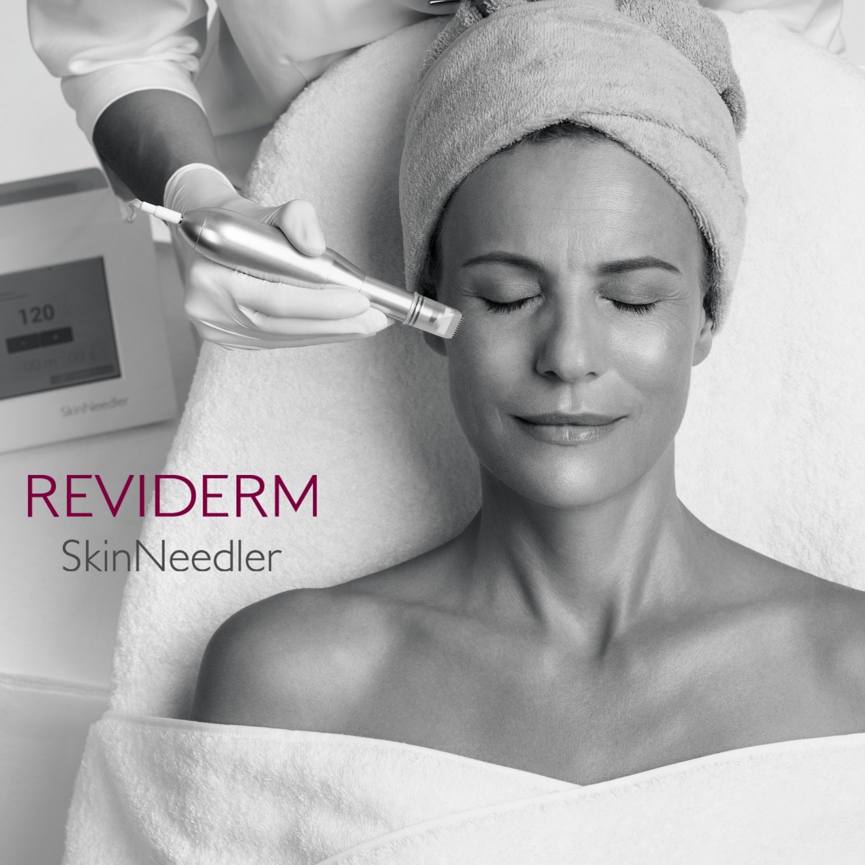 Reviderm Needeling