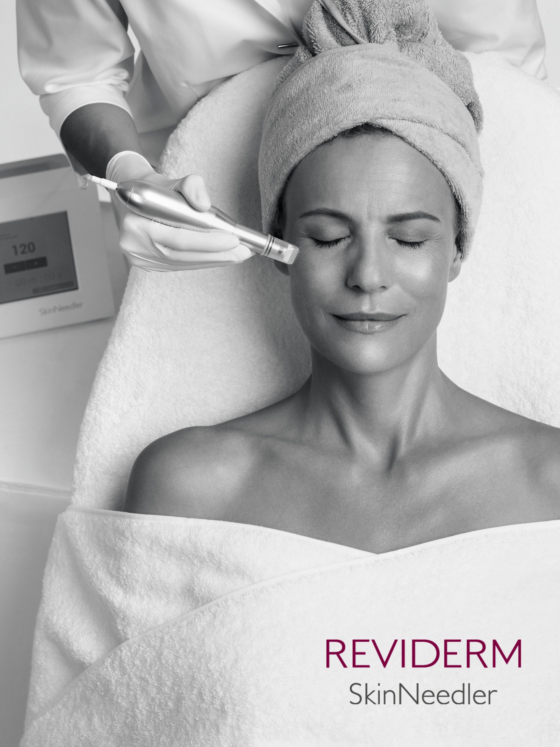 Reviderm SkinNeedler